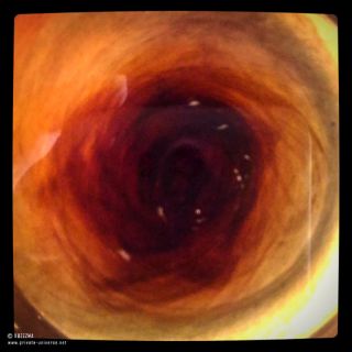 Eye of a storm (in a pitcher).